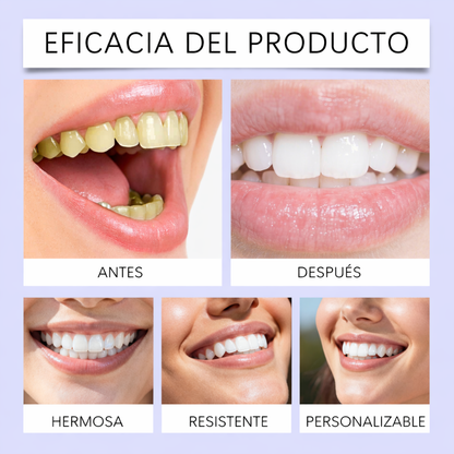 Kit Blanqueamiento Dental Dentley™ Purple (42 Unidades)