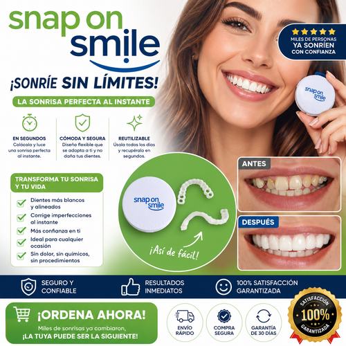 Carillas snap on smile dientes