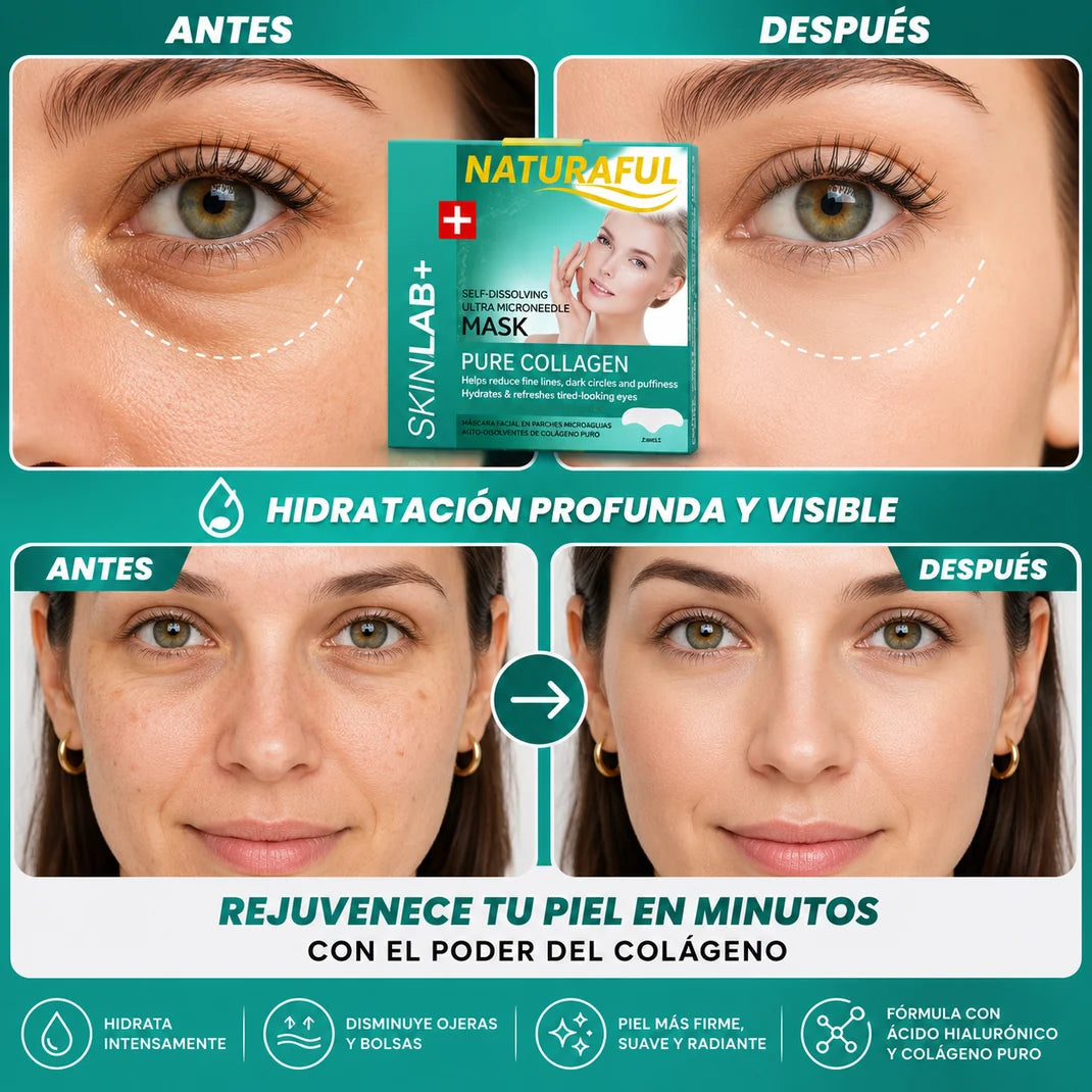 Parches colagenos autodisolvent OJERAS