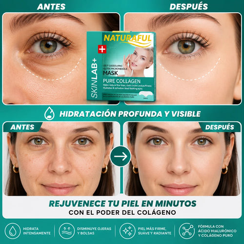 Parches colagenos autodisolvent OJERAS